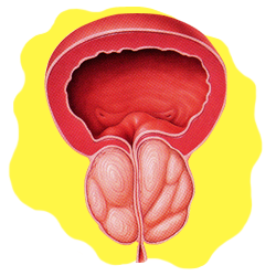 Лечение аденомы простаты