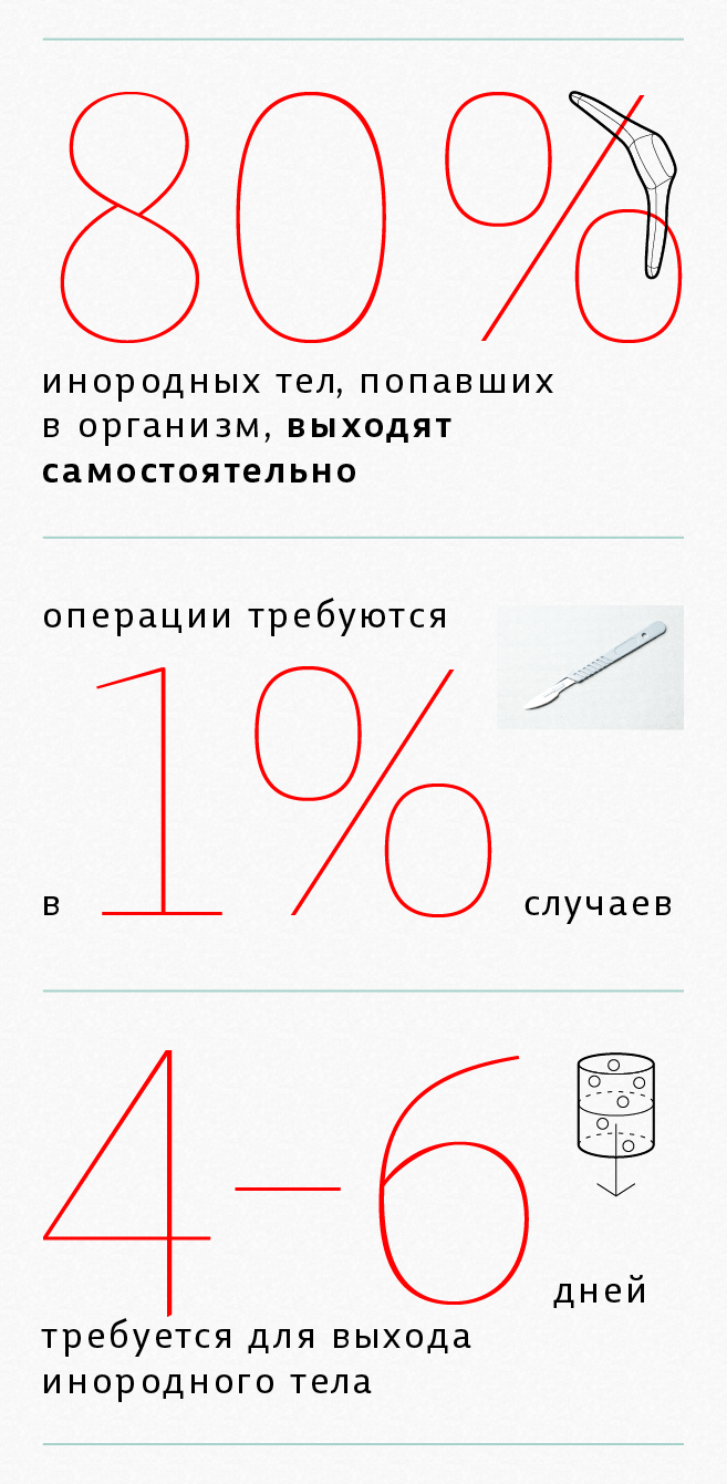 80% инородных тел, попавших в организм, выходят самостоятельно операции требуются в 1 проценте случаев 4-6 дней требуется для выхода инородного тела